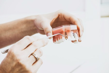 Pulpitis