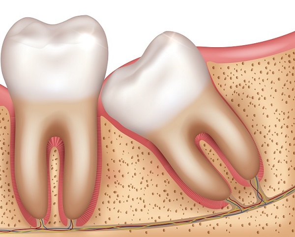 Oralna hirurgija i ugradnja zubnih implantata