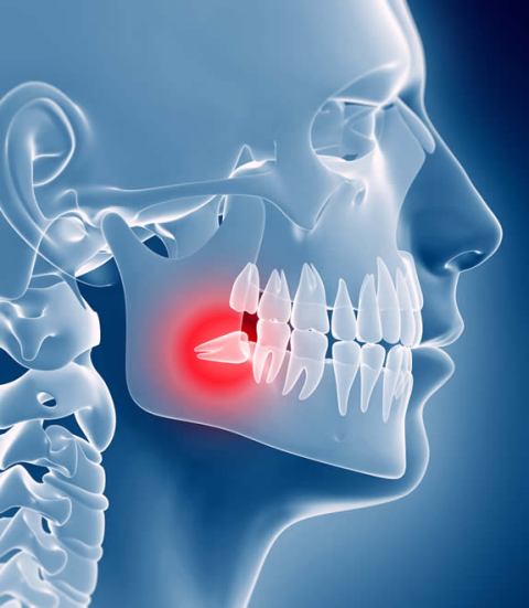 Oralna hirurgija i ugradnja zubnih implantata